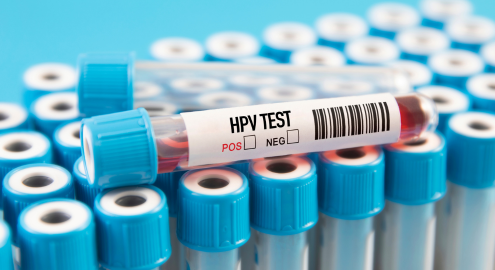 Detects High-Risk HPV Early