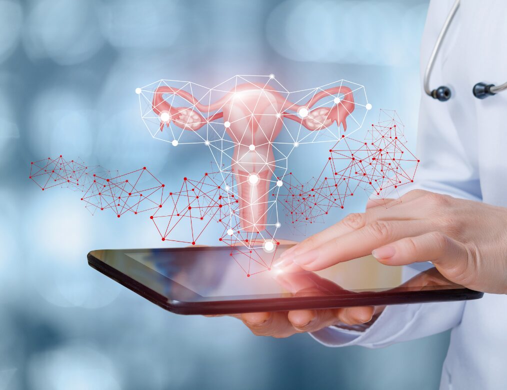 Endometriosis